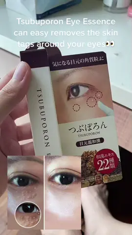 Easy removes the skin tags around your eyes👍🏻 #tsubuporon #eyes #eyecare #japan #japandrugstore #mustbuy #skintags #skintagsremoval #foryou #foryoupage #fyp #viral #singaporetiktok #beautybistro #shopontiktok 