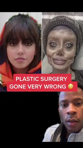 Plastic surgery gone very wrong #fyp #truestory