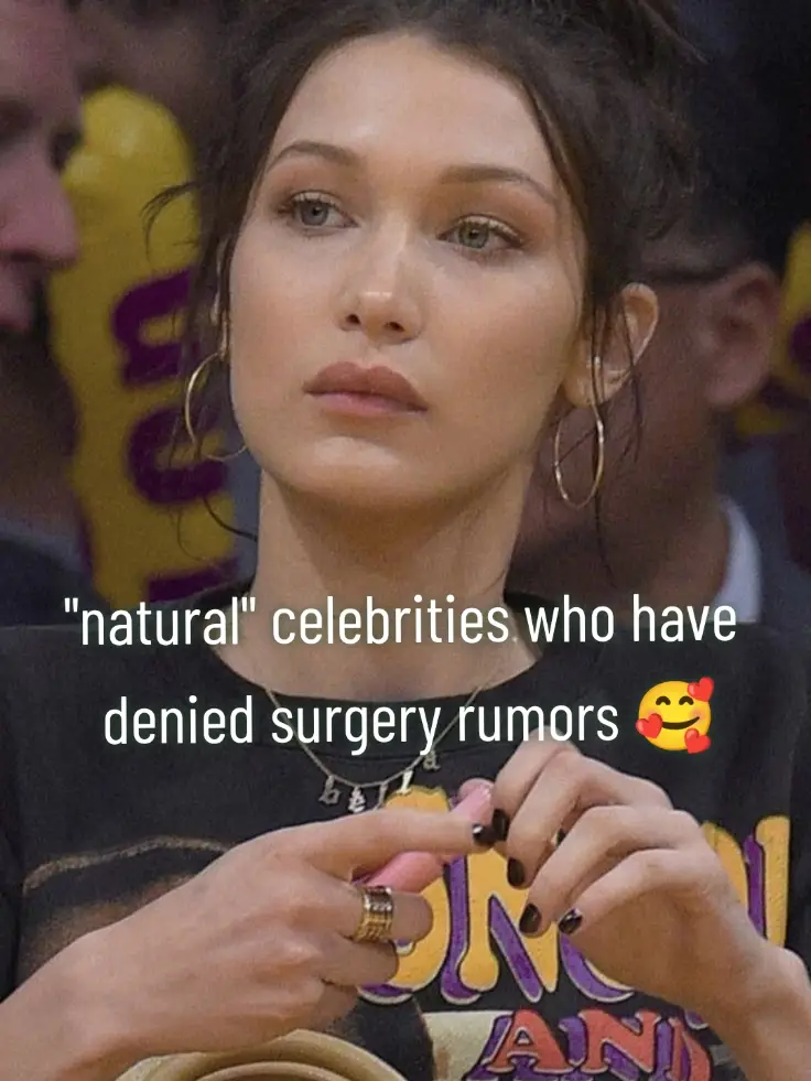 ik yall giving a side eye... #plasticbody #plasticsurgery #botox #celebrityface #celebs #beautytrends #slideshow #beforeandafter #fakebody #naturalbeauty #modeling #controversy 