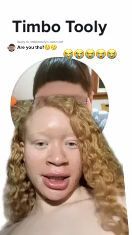 Replying to @timbootooly #greenscreen this is crazy to me😭 #albinism #albinismawareness #albinismisbeautiful #albinismcheck #albinismqueen #dontcallmethat #blackgirl #blackgirlmagic #blackgirltiktok #blackgirls 