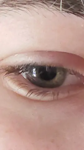 Tried this trend again #blinded #fyp #trend #goldcoast #eyes #heterochromia 