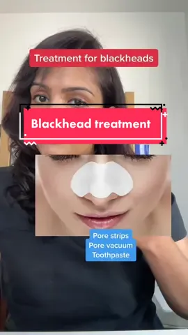 How to treat blackheads #acne #acnetreatment #salicylicacid #retinol #pores #porevacuum #porestrip 
