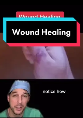 You gotta have patience! #wound #WoundHealing #Patience #Skin #Educational #Scar #Dr #Nurse #Viral #FYP