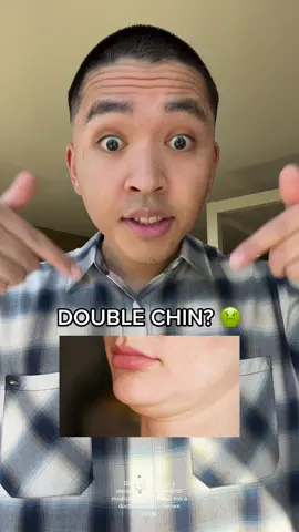 Pair with a weight-loss diet for FASTER RESULTS 🤯 #foryou #fyp #doublechin #jawline #insecure  #greenscreen 