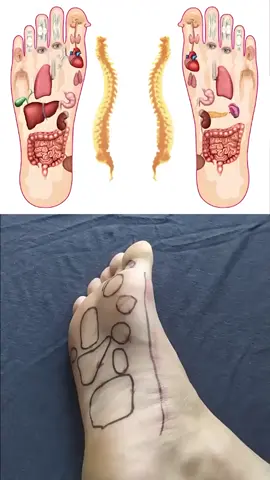 Cách bấm các huyệt ở bàn chân chữa các bệnh hữu hiệu Nguồn: Nhà thuốc Đỗ Minh Đường #cachbamhuyetchuabenh #cachbamhuyet #bamhuyet #doninhduong 