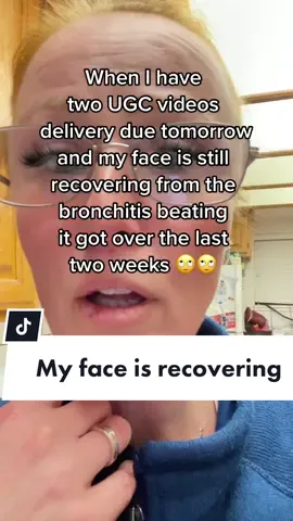 I have two UGC videos due by tomorrow and my face still looks like it got a beating. For someone who prides herself in being a responsible content creator and delivering to clients on time, this really sucks. Luckily the content is not beauty or skincare but hey, I still need to look decent in my UGC videos!!!  #ugccommunity #ugcjourney2023 #Ugc #ugccreator #ugcmom #ugcmomcreator #ugcmoms #ugcmomtok #ugcmomcreators #ugcmomcommunity #ugcmomma #ugclife #ugclifestyle #ugclifestylecontentcreator 