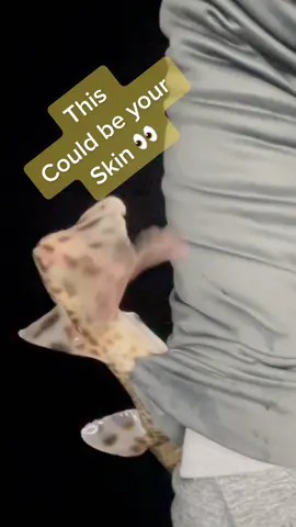 This is why its important to hold a dogfish correctly 🦈 #dogfish #dogfishshark #seafishing 