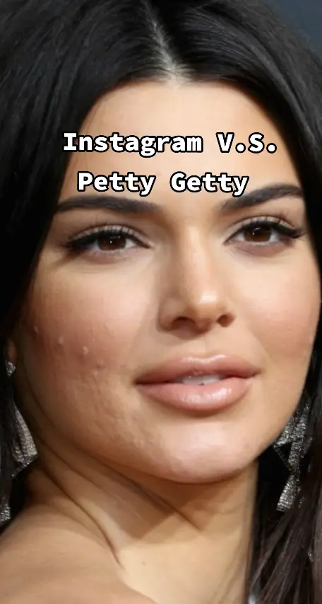 People rely heavily on photoshop and filters to look perfect on the 'gram. But what do celebrities truly look like without all of these edits? Luckily, we have Getty to show us the reality behind digital alterations. This week, Kendall Jenner was accused of photoshopping one of her pictures on Instagram. But she’s not the only one who’s faced these allegations – big sis Kim has also been suspected of editing her famous figure and skin. While stars do have a habit of using infamous apps like Facetune, nearly all of us are guilty of editing our pics. Many women are turning to filters to hide their blemishes and wrinkles. Young girls are so used to seeing fake, smooth skin and symmetrical features that it seems they forgot what a natural face looks like. #celebrity #models #beforeandafter #beforeandaftertransformation #transformation #celebrities #celebs #nofilter #gettyimages #instagramvsreality #instagramvsreallife #instagramversusreality #beautystandard #beautystandards #plasticsurgery #botox #celebritieswithoutmakeup #celebritygossip #youngandbeautiful 