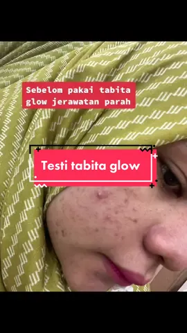 Seminggu auto glowing pakek tabita glow original ny #tabitaskincareoriginal #tabita 