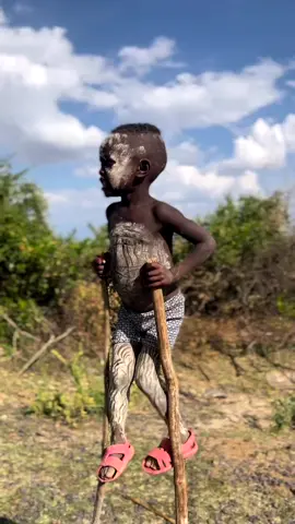 Banna tribe boys walking on stilts Omo Valley Ethiopia. #Ethiopia #OmoValley #omoriver #omoadvisor #tribe #banna #bannatribe #bannatribes #africa #culture #travelafrica #travelethiopia #culturetraveler #amazingafrica #amazing_africa #africaamazing #africa_amazing #travelworld #seeafrica #africantribes #uniquepeople #tiktokethiopia #tiktok #tiktokhabesha 