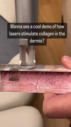 This is a cool demo of how the Picolo picosecond laser stimulates collagen in the dermis. ✨ #laser #beauty #skincare #laserhairremoval #botox #skin