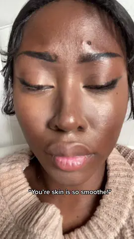 Literally ew that pimple I- 🤮 #makeup #makeuptutorial 