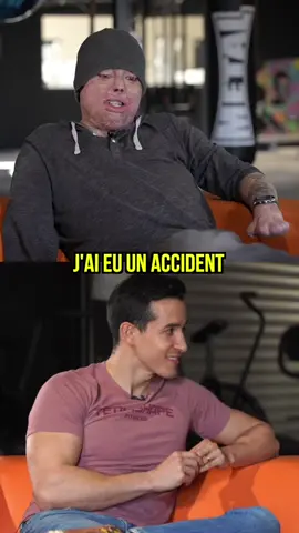 Brûlé à 97% il raconte son terrible accident @Captain Icarus respect ! 