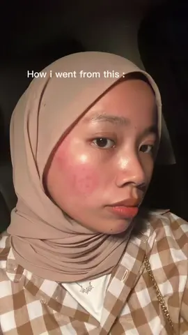 Ha sapa lgi nak kena racun tekan beg kuning cepat 😝 @skintific.my #skintificmy #fypシ゚viral #xyzbca 