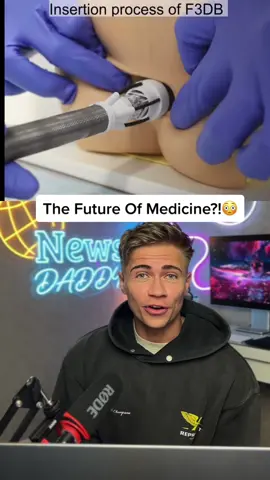 Surgery or this?! Which you choosin??😳