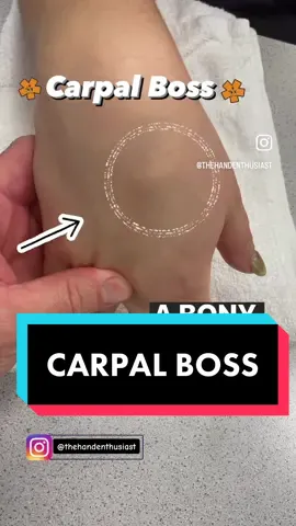 Ever seen a carpal boss before? #anatomy #handanatomy #medical #medschool #handtherapy #handinjury #extensortendons #handpain 