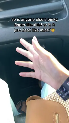 its like jello, just there wobbling 😭 #fyp #foryoupage #fypシ #foryou #fy #xyzbca #trini #trinifyp #caribbeantiktokeurs #blowthisup #trending #viral #trini_tiktoks #strange #weird #scary #pinkyfinger #idklmao 