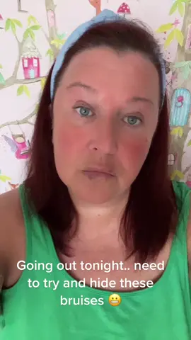 Lip fillers bruises….. #lgbtq🏳️‍🌈 #BookTok #girlswholikegirls🏳️‍🌈 