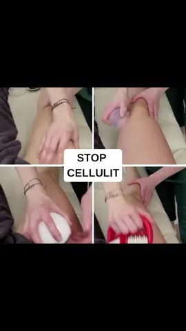 #cellulit #stopcellulit #bankachińska #idziewiosna #mobilnygabinetmasażu 