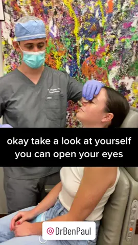 I love my job. There is so much joy in helping patients reach their goals. This patient wanted a smaller nose with less hump and a refined tip. #wishgranted #goals #rhinoplasty #drbenpaul #plasticsurgery #plastics #beauty #manhattan #rhinoplastyjourney #rhinoplastybeforeandafter #nosejobbeforeandafter #bestrhinoplasty #nosejobcheck #bestnosejob #transformationtuesday #ilovemyjob 