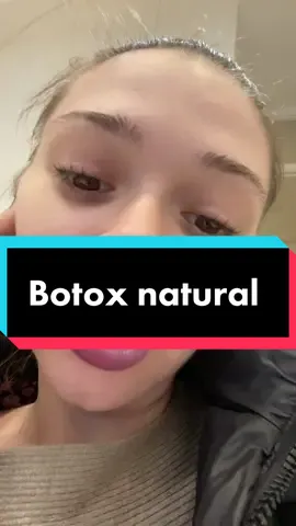 #5pasidebine #botox 
