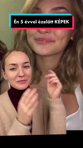 Válasz @<3 részére hát ilyen voltam…az idő azért jót tett!😁😄 Mutassak ennél is régebbi képeket?☺️ Írjátok meg kommentben!💖 #régiképek #5évvelezelőtt #tini #ezvoltam #gimis #szalagavató #szalagavatóruha #szalagavatótánc #legjobbnap #magyarsminkes #jóttettazidő #sminknélkül #nomakeupday #magyartiktokker #szalagavatos #ilyenvoltam #nosztalgia #mutatom 