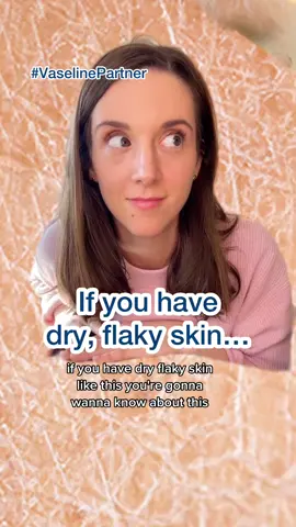 #VaselinePartner We are skipping dry skin days thanks to @vaselinebrand  Intensive Care Lotion #skintok #dryskin #skintips