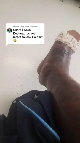 Replying to @afritumic got admitted 🏥 #painfultattoo #tattoogirl #itumeleng77 #wahala #SAMA28 #southafricatiktok #tattoo 