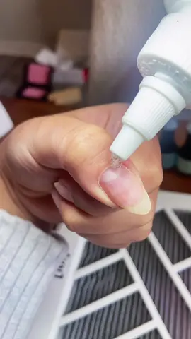 Magic sauce 🔮🪄✨💅#cuticleremoval #magictrick #dissolve#nails#nailtok#nailtiktok 