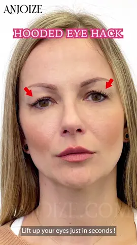 Tackle your hooded-eye-issue in just few seconds with Anjoize's Invisible Eyelid Lifter Strips Kit!