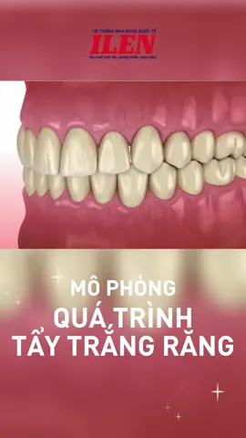 Mô phỏng Quá trình 