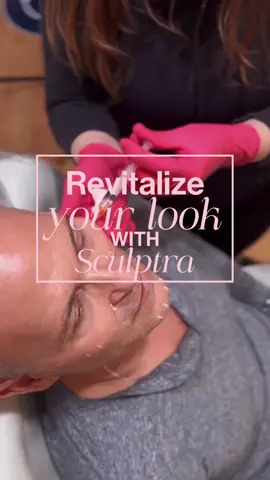REVITALIZE your look with #SCULPTRA — the ultimate choice for men who want to appear more youthful & confident ✨ . . . Schedule your consultation/appointment today at Bellora Medical Aesthetics - link in bio . . . #belloramedicalaesthetics #sculptra #nurseinjector #mensgrooming #sculptrabeforeandafter #skintransformation #facialrejuvenation #facialbalancing #sculptrafacial #reelsvideo #behindthescenes #galderma #collagenproduction #nurseinjector #nursepractitioner #endlesssummervacation #mileycyrus #seattletiktok #medspaseattle 