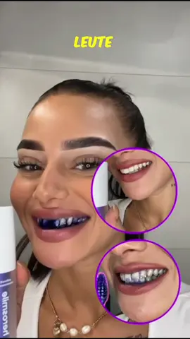 Unsere Frauen lieben dieses Serum, es lässt deine Gelbstiche in Minuten entfernen! 👀  Wir sagen Danke und geben 49% Rabatt! 💜 #herosmile #viral #zahnbleaching 