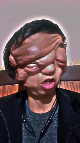 God bless her 🙏🙏🙏#disabillities #handicapped #strangedisease #disease #life #foryou #virla #trendtiktok #fypシ #fyp #fypシ゚viral 
