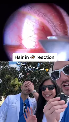 #duet with @shafereyemd #dermatologist #reaction #ingrown #cerave #aad2023 