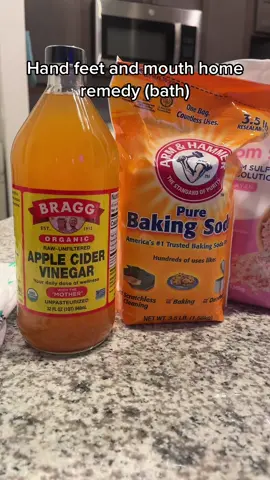 Hand feet and mouth home remedy #homeremedies #toddler #baby #handfeetandmouth #babyboy #mommygotyouforever🤞🏽 