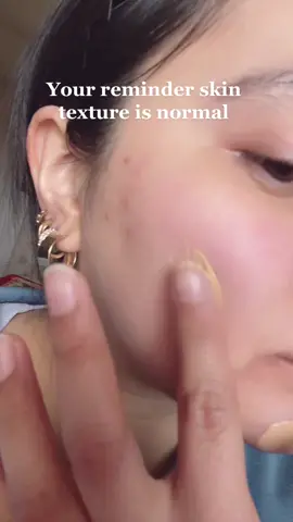 Reminder that skin texture is normal and you are beautiful! #makeup#makeuptransformation#MakeupRoutine#skin#skincare#skintexture#skintextureisnormal#skintexturepositivity#beauty#beautiful#spreadkindness#spreadlove#spreadawareness#SpreadHappiness#spreadpositivity 