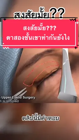 คลิปนี้รวมคำตอบไขข้อสงสัย ในการทำตาสองชั้นนะคะ ความเจ็บ=0 รับประกันความสวยที่ฟอร์เรสเท่านั้น!!!! #ศัลยกรรม #ศัลยกรรมเกาหลี #ดูแลรีอย่างโปร #ศัล #ศัลยกรรมตา #ศัลยกรรมตกแต่ง #ศัลยกรรมตา2ชั้น #ศัลยกรรมตาสองชั้น #ตาสองชั้น #ศัลยกรรมตาสองชั้น #ตาสองชั้น #ตาสองสั้นเเผลมินิ #ตาสวย #ตาสองชั้นหวานๆ #ตา #เบสเบบี๋ #โหง้วเฮ้ง #ตาสองชั้นกรีดสั้น #โหง้วเฮ้งดี #โหง้วเฮ้งดี #fypシ 