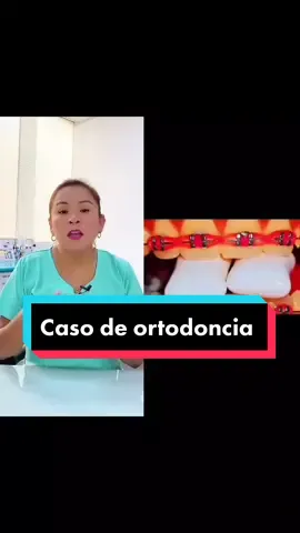 ¡No lo hagas!❌ #brackets #ortodoncia #casodental #Sonrisasegura