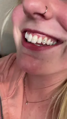 Add some gems to your smile🤌🏼  Book me on IG : LiraAesthetic ✨ #latinamicroinfluencer #teethgems #latinabusinessowner #azbusiness #bookme #supportlatinabusinesses 