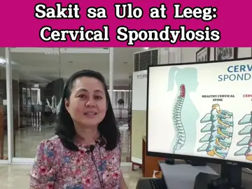 Sakit sa Ulo at Leeg Cervical Spondylosis. - By Doc Liza Ramoso-Ong