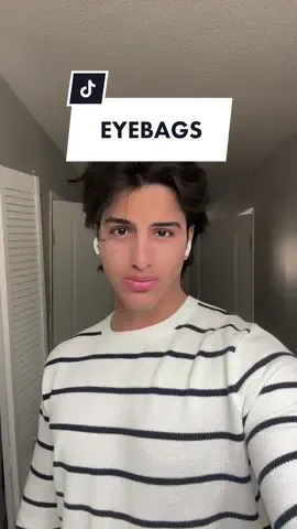 use ice if your undereye is puffy 🧊 #fyp #syrianpsycho #SelfImprovement #undereyebags #trending 