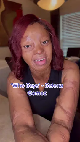 I wouldn't wanna be anybody else but the me i was born to be🥰 i hope more and more people get to feel this way.  'Who Says’ - @selenagomez  #selenagomez #unapologeticallyme #selflove #foryoupage #fyp #foryou #rawvocals #burnsurvivor #kechiokwuchi #beautyinscars #morethanmyscars 