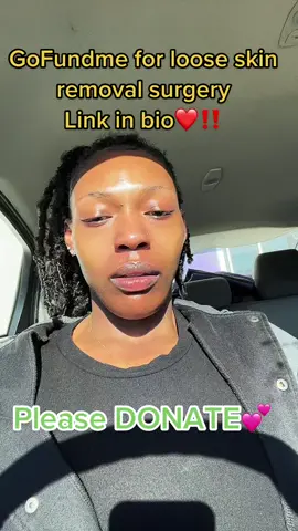 #gofundme #linkinbio #donate #looseskinremoval #lifeaftergastricbypass #weightloss #gastricbypass #wls #series #series #journey #fyp #foryou #fypシ #foryoupage #trending #viral #blowthisup 