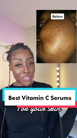 BEST Vitamin C Serums (For all skins) 😉 #glowingskin #blackskin #allskintypes #vitamincserum #vitamincserums #glowyskincare #glowyskin #skincaregoals 