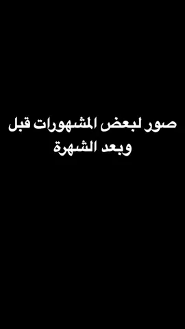#ترند_تيك_توك #صور_بعض_المشهورات_قبل_وبعد_الشهرة #ربنا_شاهد #pyfツviral_❤ #لايك__explore___ #جيزان_ابوعريش🇸🇦 