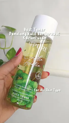 Best Toner untuk kulit berjerawat & bruntusan🥰 ada yg sama??? @npureofficial  #npurecicaseries #tonercicanpure #acnetoner #cicatonernpure #tonerjerawat #rekomendasitoneruntukkulitberjerawat #hydratingtone 