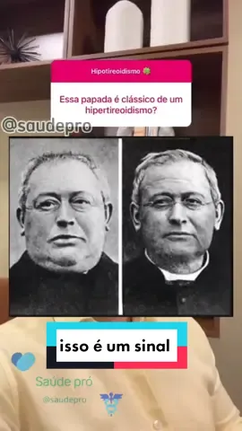 A papada e um sinal de hipotireoidismo?#dicas #saude #hipotiroidismo 