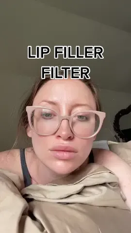 I hope whoever made this filter is never allowed to do injections 😅 #lipfiller #lipfillerfilter 