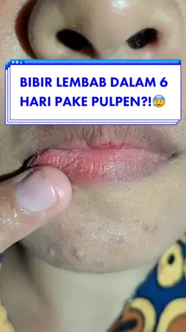 YES! Lip Infusion emang efektif banget mencerahkan dan mengunci kelembaban kulit bibir kamu karena kandungan Collagen dan Vitamin C nya🤩🫶🏻 Masih belum cobain⁉️ #SerunyaBareng #jieraserumbibir #bibirantitandus #jieraofficial #jieragenderless #eksfoliasibibir #jierascrub #xyzbca 